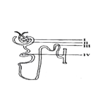 The parts labelled 1 and II make up the