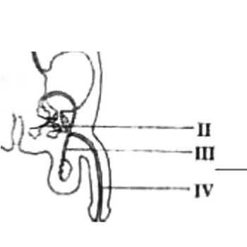 Birth control by vasectomy is achieved by severing the structure labelled.